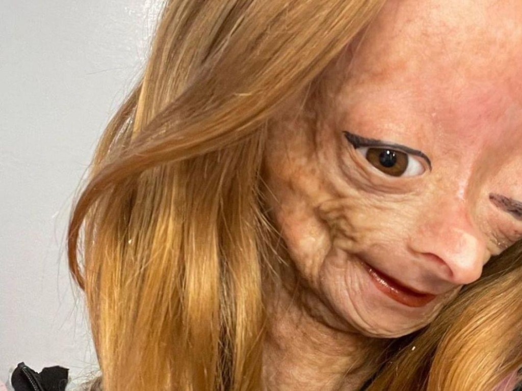 Muere, a los 15 años de edad, Adalia Rose Williams, youtuber que vivía con progeria
